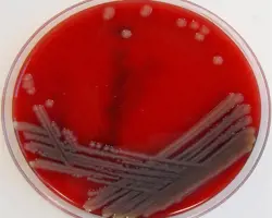 آزمون بیماریهای باکتریایی در قزل آلا و ماهی خاویاری(ردیابی باکتری Aeromonas salmonicida به روش PCR) آزمون بیماریهای باکتریایی در قزل آلا و ماهی خاویاری(ردیابی باکتری Aeromonas salmonicida به روش PCR)