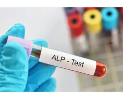 آزمون کبدی در سگ و گربه(ALP)