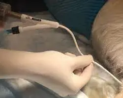 سوندگذاری ماده