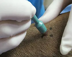 آزمایش ارزیابی پوستی