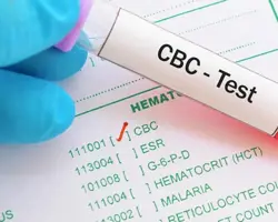 آزمایش CBC